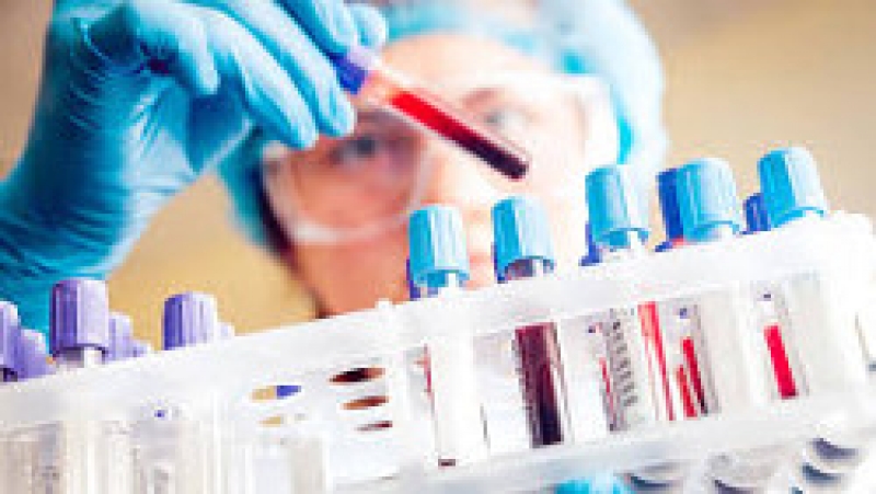 День профилактики СПИДа. Проверь себя на ВИЧ